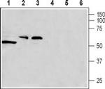 CACNG8 Antibody in Western Blot (WB)
