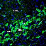 TRPM2 (extracellular) Polyclonal Antibody