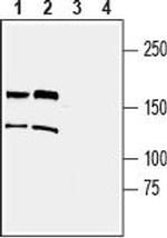 TRPM2 (extracellular) Antibody in Western Blot (WB)