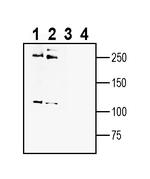 CaV1.2 (CACNA1C) (extracellular) Antibody in Western Blot (WB)
