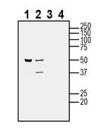 CALHM2 (extracellular) Antibody in Western Blot (WB)