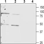 Connexin-40 (GJA5) Polyclonal Antibody