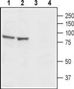 CatSper1 (extracellular) Polyclonal Antibody