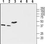 MCUR1 (CCDC90A) Polyclonal Antibody