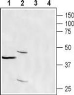 CRACR2A (EFCAB4B) Polyclonal Antibody