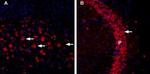 CHERP Polyclonal Antibody, Atto™ 594