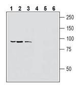 TRPV1 (extracellular) Polyclonal Antibody