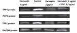 ACD Antibody in Western Blot (WB)
