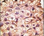 ACE2 Antibody in Immunohistochemistry (IHC)