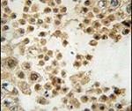 ACE2 Antibody in Immunohistochemistry (IHC)