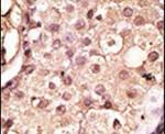 ACE2 Antibody in Immunohistochemistry (IHC)