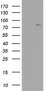 ACE2 Antibody in Western Blot (WB)