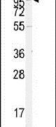 ACE2 Antibody in Western Blot (WB)