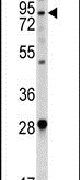 ACE2 Antibody in Western Blot (WB)