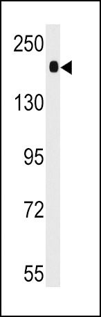 ACE Antibody in Western Blot (WB)