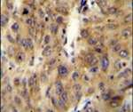 A1CF Antibody in Immunohistochemistry (IHC)