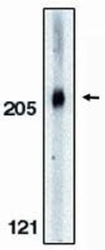 Acinus Antibody in Western Blot (WB)