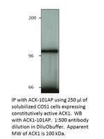 ACK1 Polyclonal Antibody