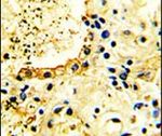 ACK1 Antibody in Immunohistochemistry (IHC)