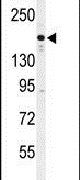 ACK1 Antibody in Western Blot (WB)