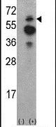 ACK1 Antibody in Western Blot (WB)