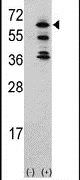 ACK1 Antibody in Western Blot (WB)