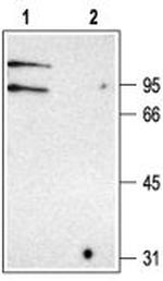 CLC-K Polyclonal Antibody