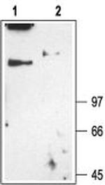 CLC-1 (CLCN1) Polyclonal Antibody