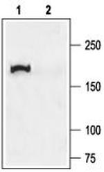 CFTR Antibody in Western Blot (WB)