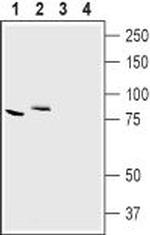 CLC-7 (CLCN7) Polyclonal Antibody
