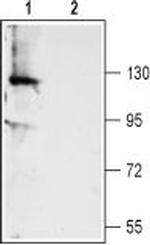 TMEM16A (ANO1) (extracellular) Polyclonal Antibody
