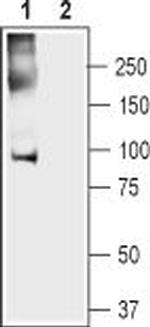 Anoctamin-5 Polyclonal Antibody