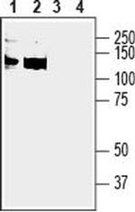 Anoctamin-6 (extracellular) Polyclonal Antibody