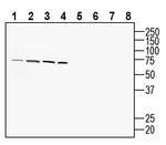 PACC1/TMEM206 (extracellular) Antibody in Western Blot (WB)