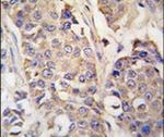 Aconitase 2 Antibody in Immunohistochemistry (IHC)