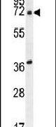 ACOT11 Antibody in Western Blot (WB)
