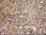 ACOT12 Antibody in Immunohistochemistry (Paraffin) (IHC (P))