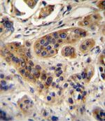 ACOX1 Antibody in Immunohistochemistry (IHC)