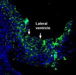 PMCA3 Polyclonal Antibody