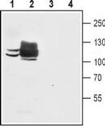 SERCA1 Antibody in Western Blot (WB)
