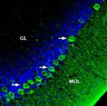 SERCA3 Polyclonal Antibody