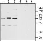 CXCR2 (extracellular) Polyclonal Antibody
