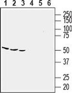 CCR5 (extracellular) Antibody in Western Blot (WB)