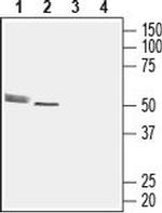 CMKLR1 (extracellular) Polyclonal Antibody
