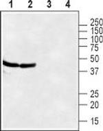 CXCR7 (ACKR3) (extracellular) Polyclonal Antibody