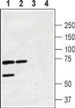 Calcitonin Receptor (extracellular) Antibody in Western Blot (WB)