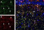 CX3CR1 (extracellular) Antibody in Multiplex Immunohistochemistry (mIHC)