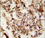 Acrosin Antibody in Immunohistochemistry (IHC)