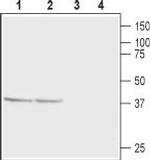 CaBP1 Polyclonal Antibody