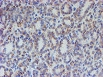 ACSF2 Antibody in Immunohistochemistry (Paraffin) (IHC (P))